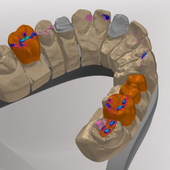 Фотография модели, отсканированной на 3D сканере Smartoptics scanBox pro (2)