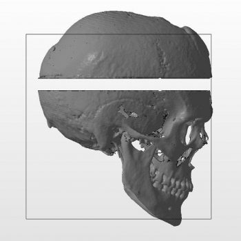 Фото 3D моделирования черепа