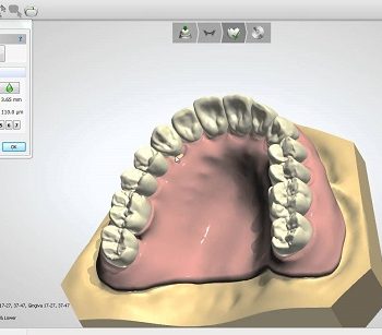 Изображение Софт для стоматологии Dental System Full Contour 1