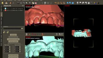 Софт для стоматологии DDS-Pro
