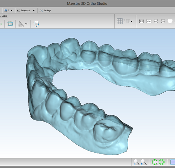 Изображение Сфот для стоматологии Maestro 3D Ortho Studio 1