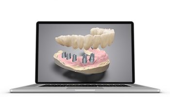 Модуль для DWOS (балки и мосты с винтовой фиксацией)