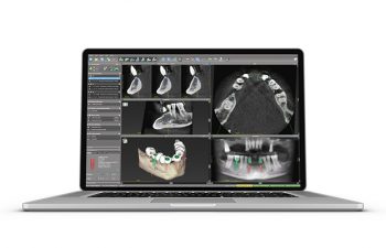 Модуль для DWOS coDiagnostiX