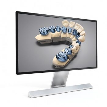 Модуль для DWOS (Коронки и мосты)