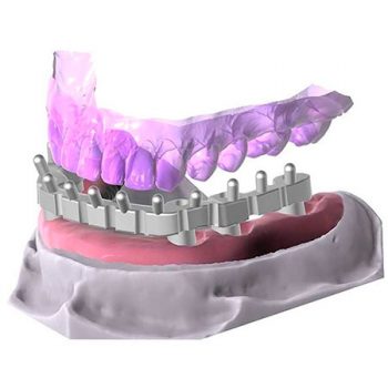 Модуль Exocad Bar