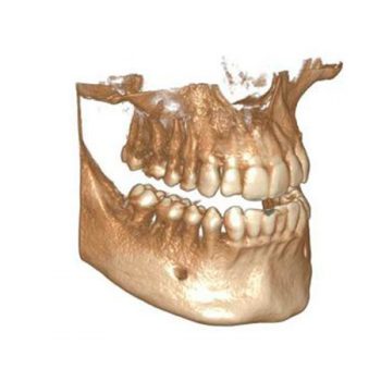 Модуль Exocad DICOM Viewer