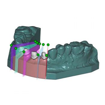 Модуль Exocad Model Creator