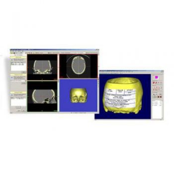 Софт для стоматологии 3D Systems Mimics Z