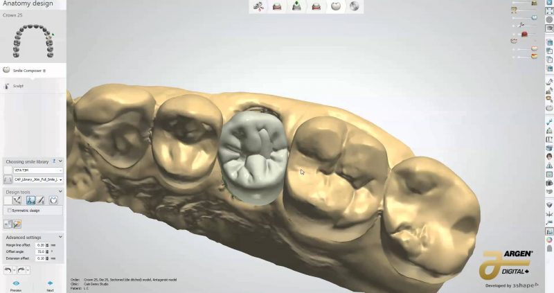 Фото ПО для стоматологии 3Shape Dental System_1