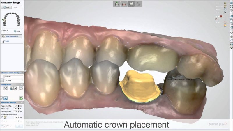 Фото ПО для стоматологии 3Shape Dental System_2