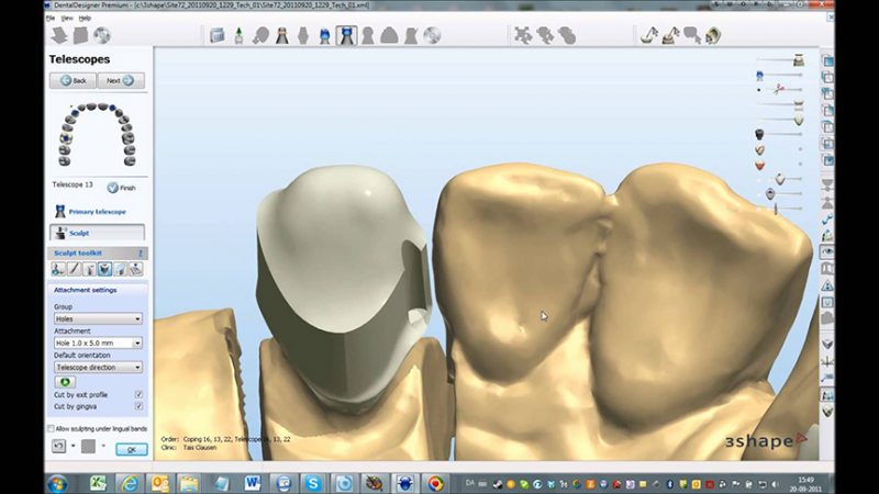 Фото ПО для стоматологии 3Shape Dental System_3