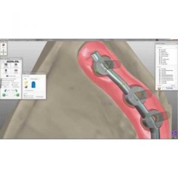 Софт для стоматологии Exocad basic демо-версия