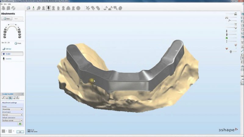 Фото ПО для стоматологии Implant Bar and Bridge Design - 1 seat _1