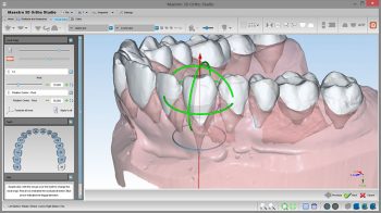 Софт для стоматологии Maestro 3D Ortho Studio