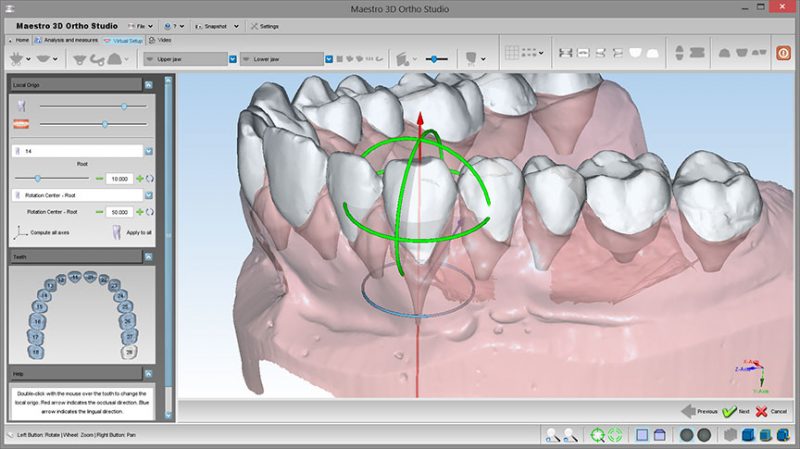 Фото ПО для стоматологии Maestro 3D Ortho Studio