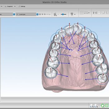 Фото ПО для стоматологии Maestro 3D Ortho Studio_1