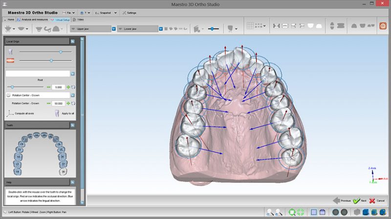 Фото ПО для стоматологии Maestro 3D Ortho Studio_1
