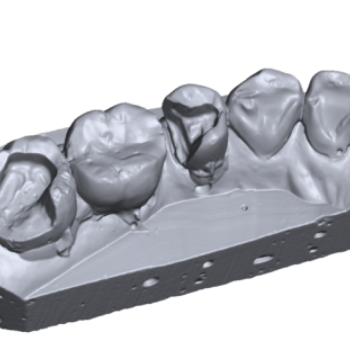 Изображение модели, отсканированной на 3D сканере Medit Identica T300 (1)