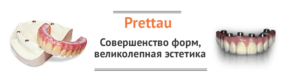 Баннер Prettau 1