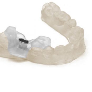 Изображение модели, напечатанной фотополимером HARZ Labs Dental Clear SLA/Form-2 (1)