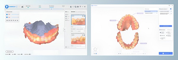 Фото интраорального сканера Shining 3D Aoralscan 3 Light 10