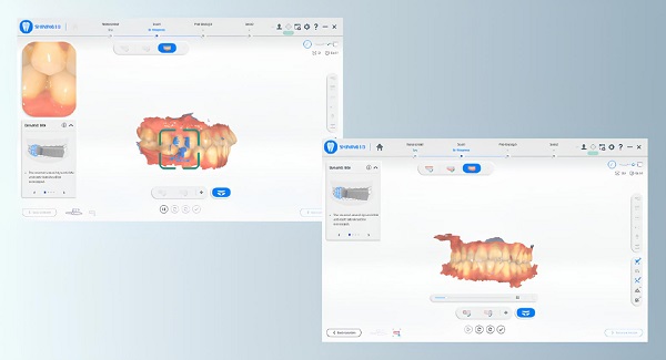 Фото интраорального сканера Shining 3D Aoralscan 3 Light 15