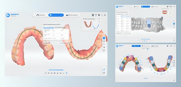 Фото интраорального сканера Shining 3D Aoralscan 3 Light 9