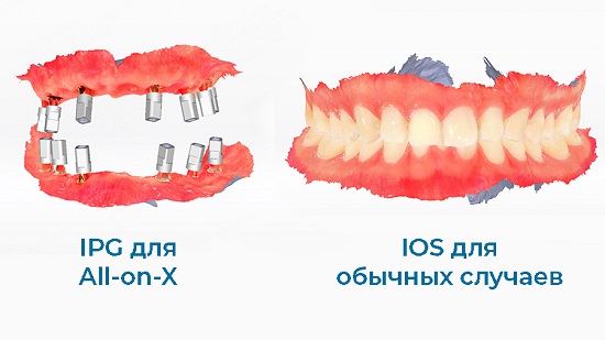 Фото Интраоральный 3D-сканер Aoralscan Elite Wireless 3