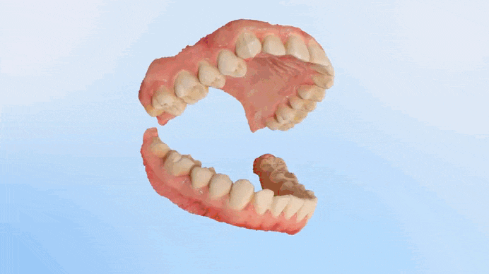 Фото Aoralscan Elf проводной интраоральный сканер Shining 3D 2