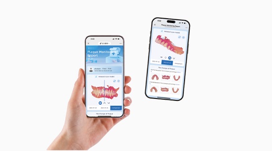 Фото Aoralscan Elf проводной интраоральный сканер Shining 3D 4